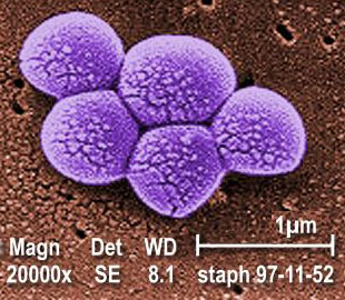 MRSA