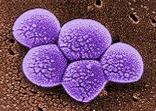 MRSA Picture